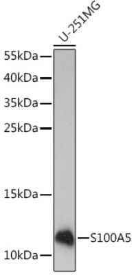 Western Blot: S100A5 Antibody [NBP2-93842] - Western blot analysis of extracts of U-251MG cells, using S100A5 Rabbit pAb (NBP2-93842) at 1:1000 dilution. Secondary antibody: HRP Goat Anti-Rabbit IgG (H+L) at 1:10000 dilution. Lysates/proteins: 25ug per lane. Blocking buffer: 3% nonfat dry milk in TBST. Detection: ECL Enhanced Kit. Exposure time: 3min.